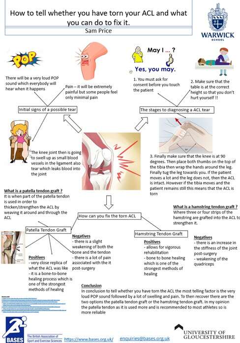 BASES Outreach Projects: Sam Price wins the BASES School Poster Competition